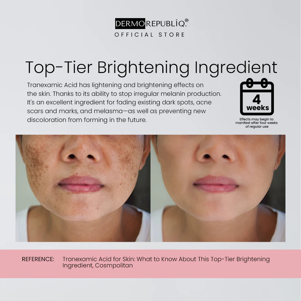 Dermorepubliq 10% Niacinamide +3% Tranexamic Acid +2% Alpha Arbutin Ultra White Serum 30ml