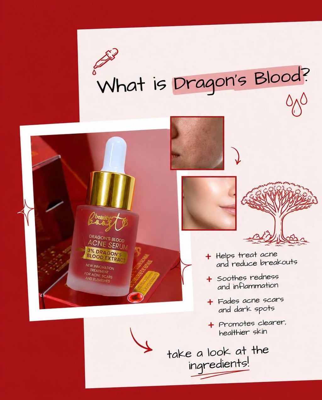 Beauty Boost Dragon's Blood Acne Serum
