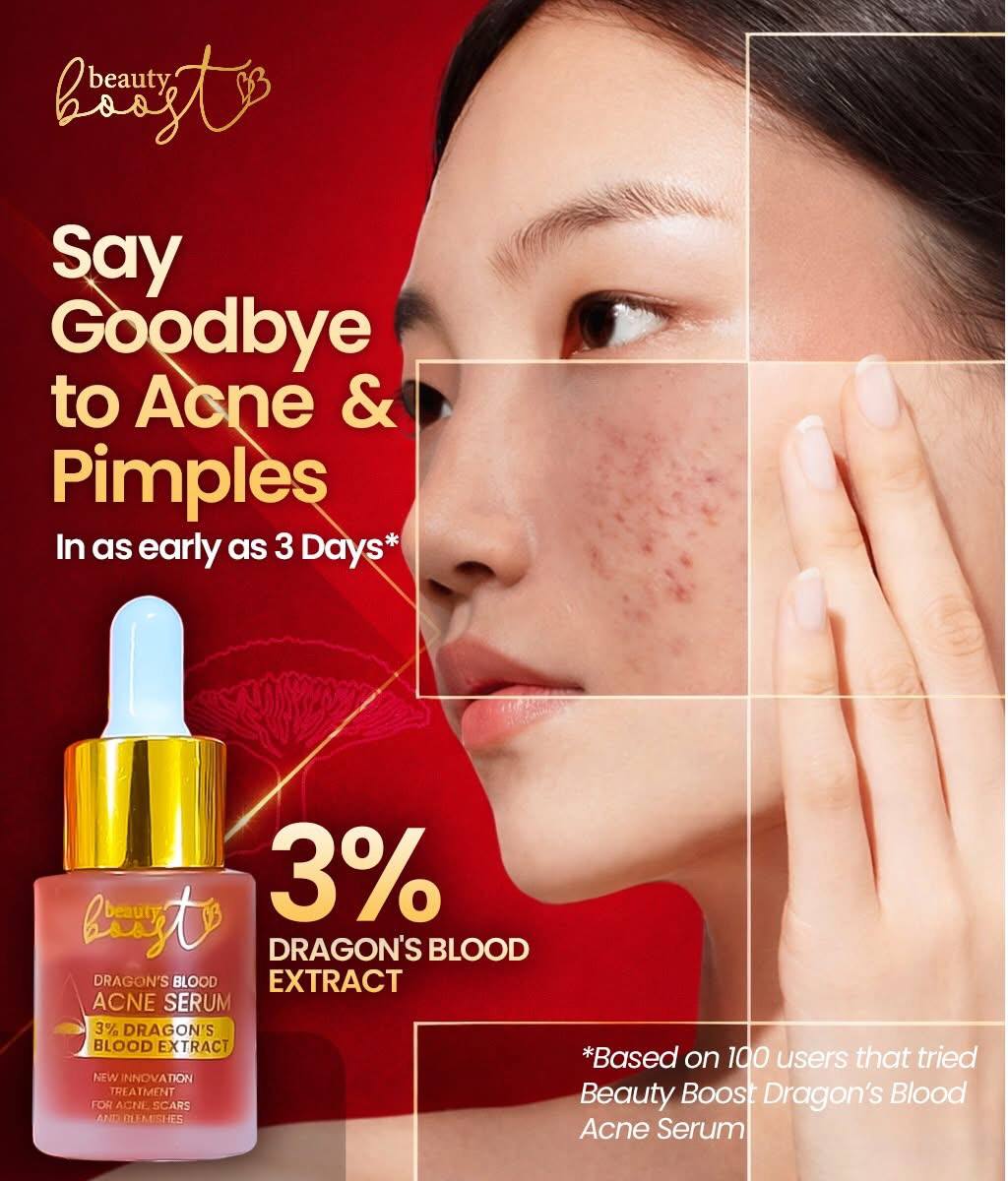Beauty Boost Dragon's Blood Acne Serum