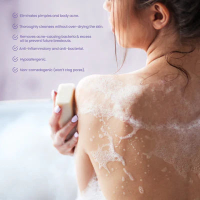 Belo Essentials AcnePro Pimple-Fighting Bar