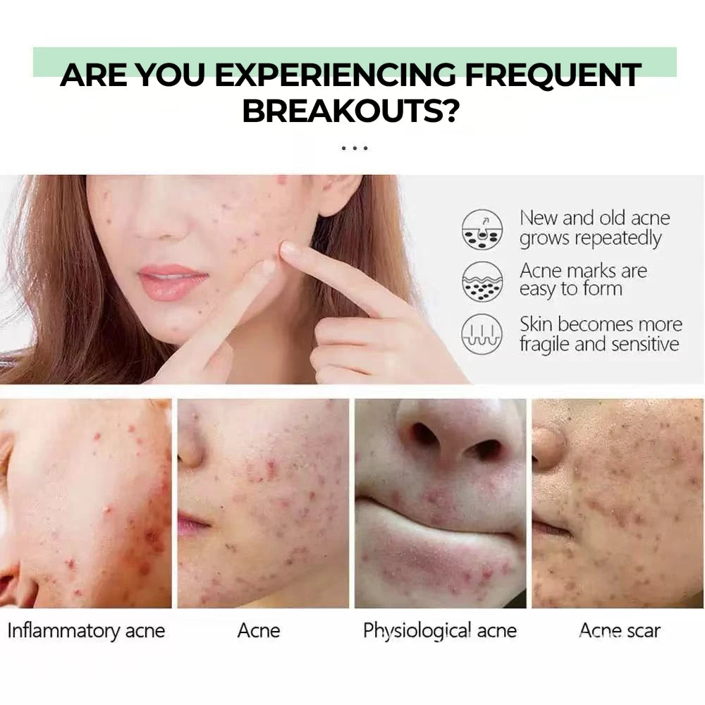 Unar Alpha Arbutin Whitening Ampoule Face Serum