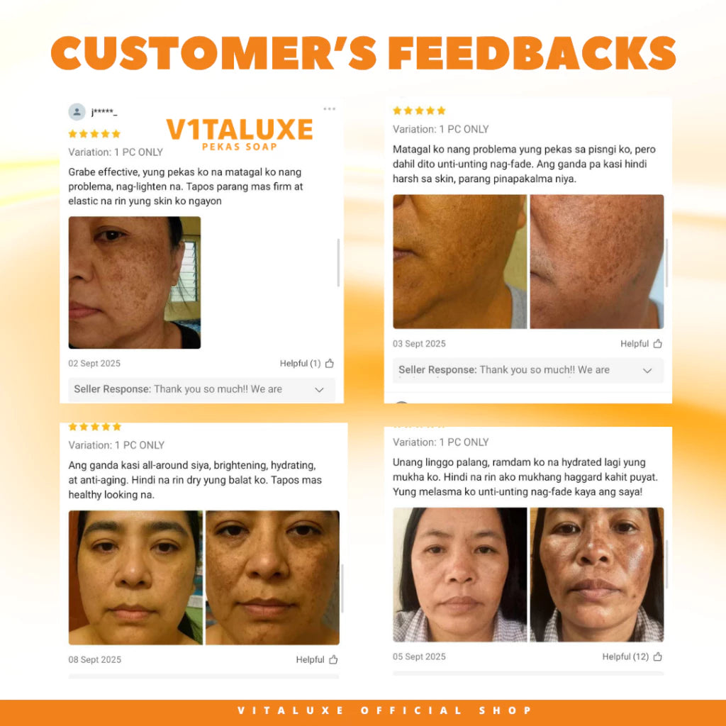 Vitaluxe Pekas and Melasma Soap