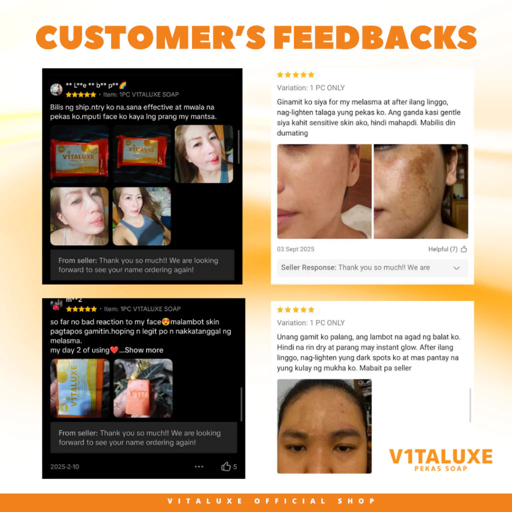 Vitaluxe Pekas and Melasma Soap
