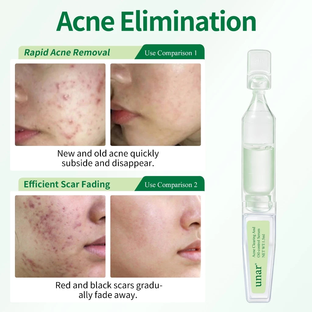 Unar Alpha Arbutin Whitening Ampoule Face Serum