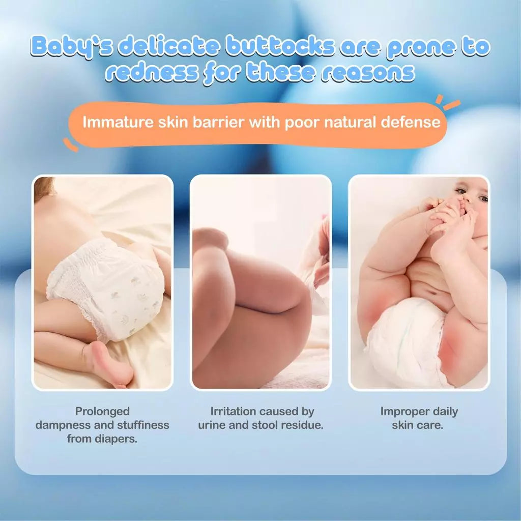 Tenderoo Baby Diaper Rash Cream 20g