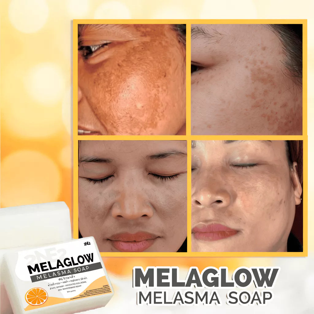 2ne2 Melaglow Melasma Soap