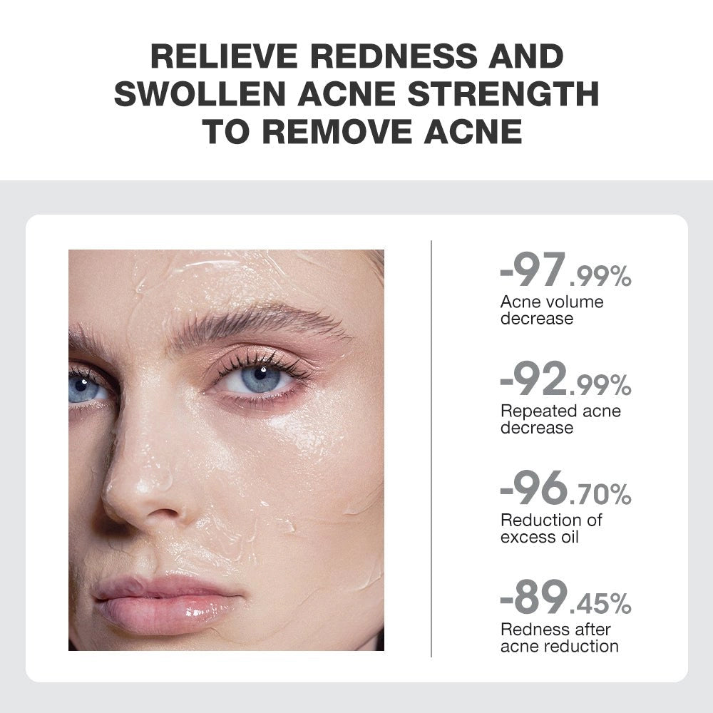 SKINEVER Salicylic Acid Acne Treatment Ice Sleep Masque